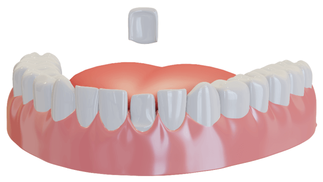 tooth and mirror tool