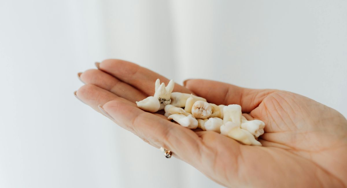 Tooth Extraction