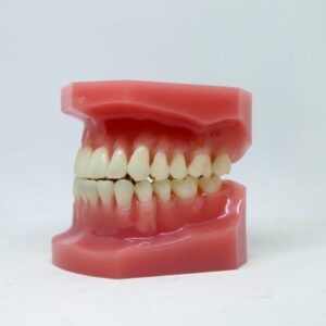 teeth whitening